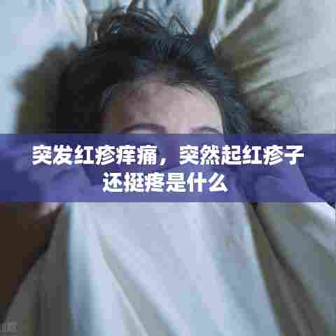 突发红疹痒痛，突然起红疹子还挺疼是什么 