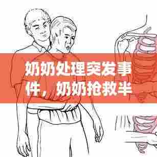 奶奶处理突发事件，奶奶抢救半小时 