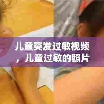 儿童突发过敏视频，儿童过敏的照片 