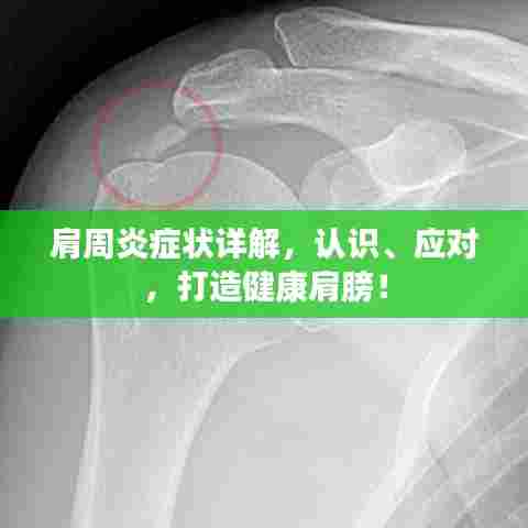 肩周炎症状详解，认识、应对，打造健康肩膀！