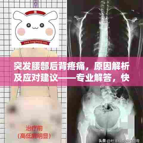 突发腰部后背疼痛，原因解析及应对建议——专业解答，快速缓解病痛
