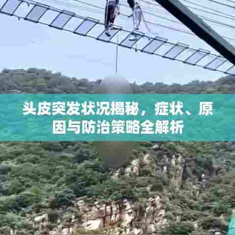 头皮突发状况揭秘，症状、原因与防治策略全解析