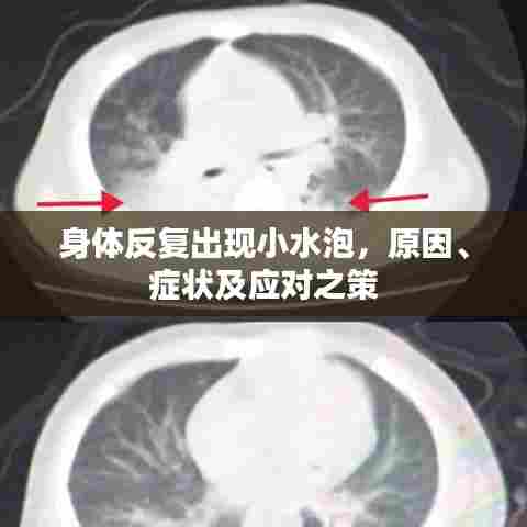 身体反复出现小水泡，原因、症状及应对之策