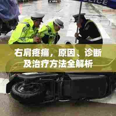 右肩疼痛，原因、诊断及治疗方法全解析